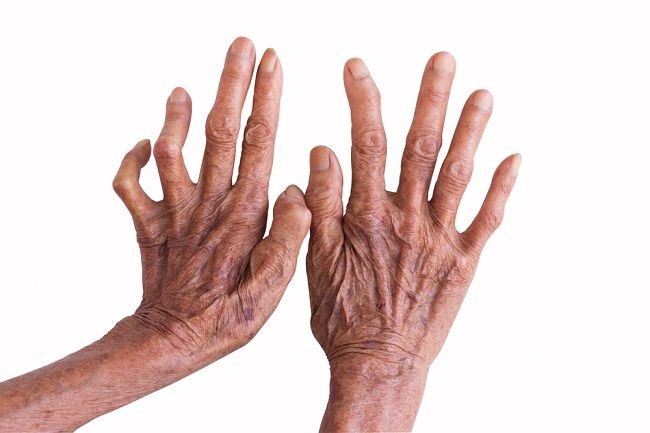 alodokter.com